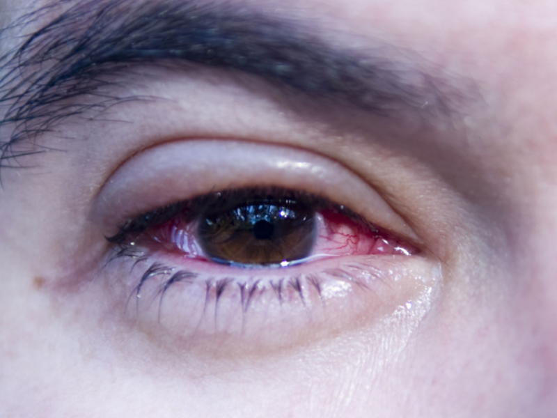 Los municipios más afectados son: Choloma, Villanueva y Puerto Cortés.