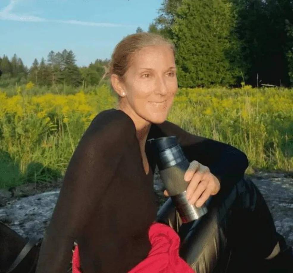 Céline Dion es una cantante canadiense. Conocida por su voz poderosa y técnicamente hábil, Dion es la artista canadiense y la cantante francófona más exitosa de todos los tiempos. En la foto, su piel es clara, con algunas manchas de la edad, pero notoriamente con mucho cuidado que la hace lucir radiante a sus 55 años.