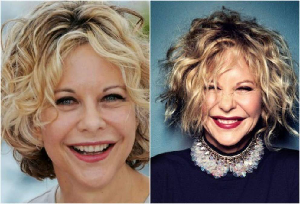 Pese a que Meg Ryan niega el uso de bótox, sus fotos del pasado la delatan.