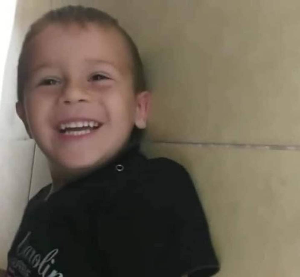 - “La causa de la muerte fue el edema cerebral como consecuencia de politraumatismos, circunstancia que el Dr. Toulouse amplió durante el debate, explicando que ese edema al no poder hincharse el cráneo, como pasaría con cualquier otra parte del cuerpo, provoca el enclavamiento de las amígdalas cerebelosas que producen un paro cardíaco. Pero también explicó que otras lesiones internas indicadas en la autopsia habrían provocado la muerte por hipovolemia, si no se hubiera producido el paro cardíaco que detuvo -naturalmente- el flujo sanguíneo”.