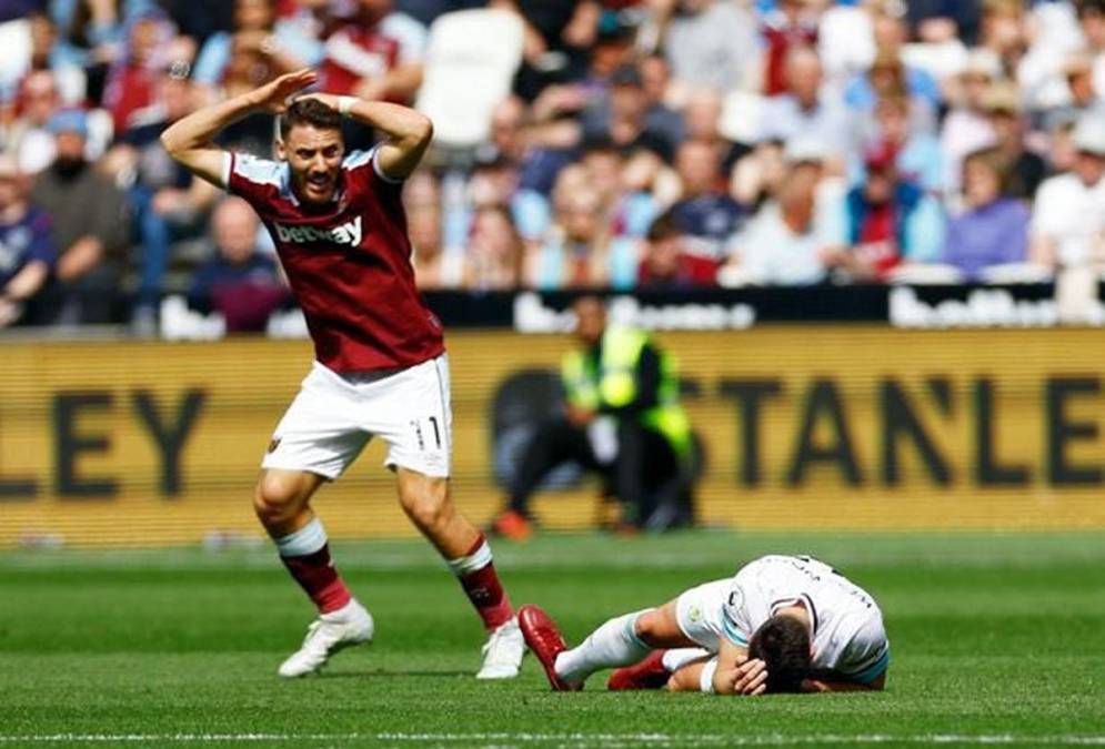 El jugador del Burnley estaba tendido sobre el terreno de juego con el pie derecho completamente torcido, de manera antinatural. 