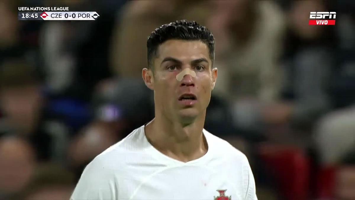 El portugués volvió al campo minutos después con una curita en su nariz.
