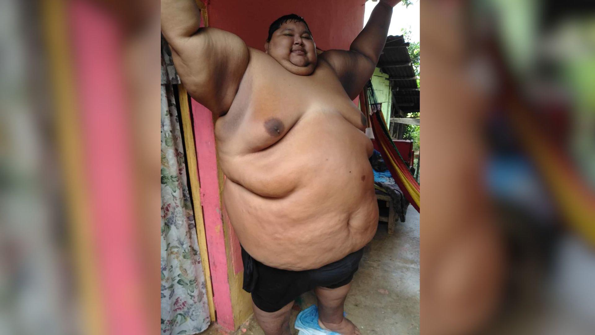 Así cambió la vida de Elder Castillo tras perder más de 500 libras