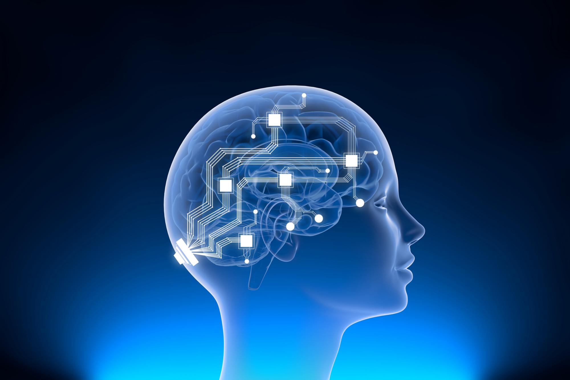 Implantes cerebrales: la carrera hacia el cíborg cobra impulso