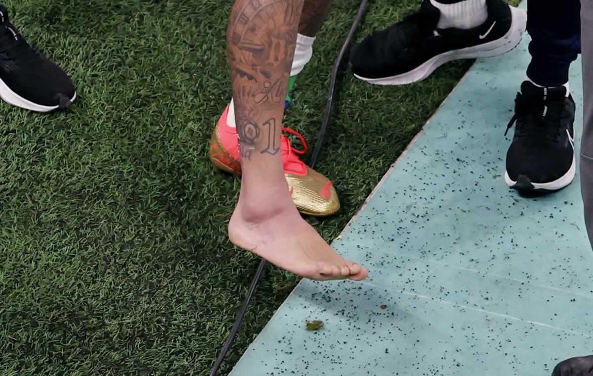 Así luce el tobillo derecho de Neymar.